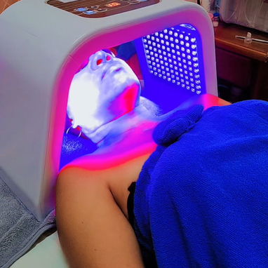 ✨ LIMPIEZA FACIAL PROFUNDA EN LA HABANA ✨ - 7/10
