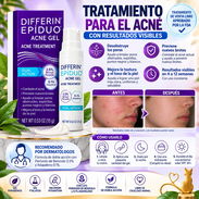 Gel para el Acné Differin Epiduo – Adapaleno 0.1% + Peróxido de Benzoilo 2.5% | 15 g - Img 58122250