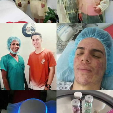 Tratamientos anti acné manchas y arrugas y limpieza facial profunda - Img 119003962