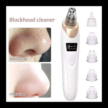 Limpiador facial recargable, extractor de puntos negros, succionador de espinillas. - Img 121991407