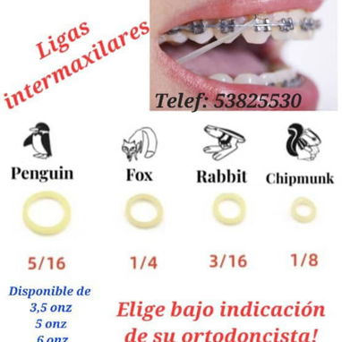 Resina para brackets. Kit Ortodoncia. Ligas intermaxilares - Img 118692526