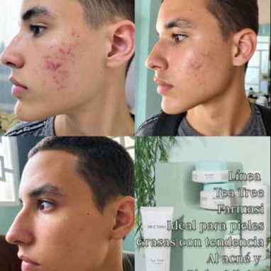 Anti acné FARMASI - 6/6