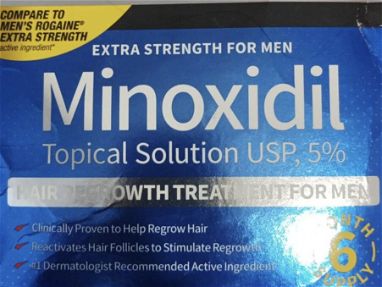 Minoxidil tratamiento - Img 66061859