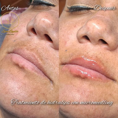 🔥 ¡CAMBIA TU ROSTRO, ELEVA TU BELLEZA HOY! 🔥 ¿Lista para verte más joven, radiante y segura desde la primera sesión? - Img 121663394