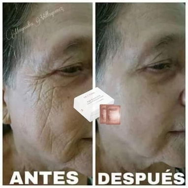 Botox instantáneo Farmasi - Img 120231100