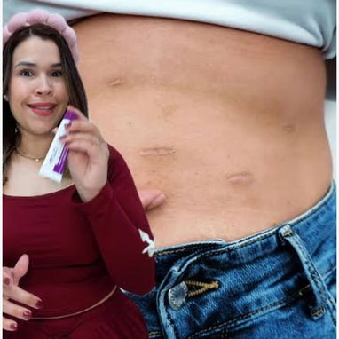 Gel para Cicatrices Cicatricure - 8/10