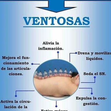 Masajes con ventosas - Img 120886131