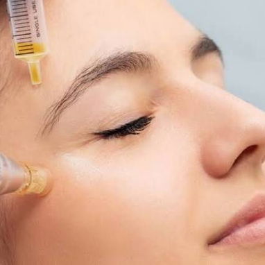 PRP Facial. Medicina Estética para tu eterna juventud - Img 126193391