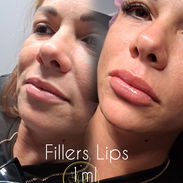 Spa_leydis 🪷 ubicado en Marianao donde resaltamos tu belleza de forma natural - Img 57430943