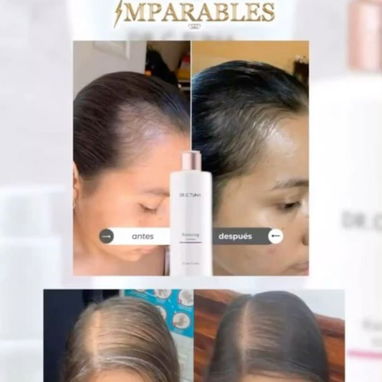 Champú y Mascarilla Capilar Reviving de FARMASI.Para cabello frágil y caída de cabello. - Img 125504158
