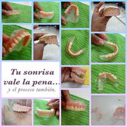 Prótesis dentales - Img 55775619