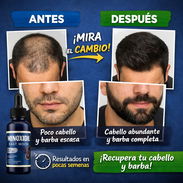 💪 Minoxidil East Moon – Caja de 3 frascos (60 ML c/u) ✨ Resultados visibles en pocas semanas 💰 Precio: 20 USD 📦 - Img 55471643