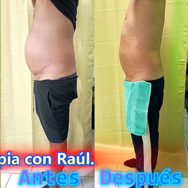 🔥 ¡CAMBIA TU ROSTRO, ELEVA TU BELLEZA HOY! 🔥 ¿Lista para verte más joven, radiante y segura desde la primera sesión? - Img 121663380