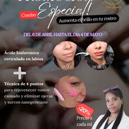 💋 Labios que hablan por ti Más volumen, más hidratación y una forma que realza tu belleza natural ✨ - Img 54840305