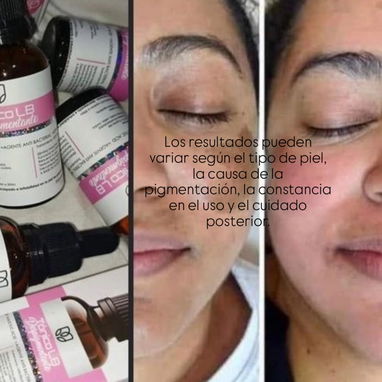 Tónico LB aclarante Anti-Imperfecciones despigmentante quita y aclara manchas uso nocturno todo el cuerpo - Img 117119597