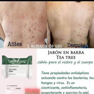 Jabón para el acné - Img 54732931