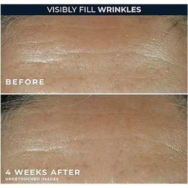 RoC Retinol Correxion Deep Wrinkle Filler (30 ml) | Con garantía | videojuegoshabana.com - Img 123124801