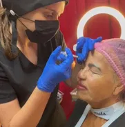 Tratamiento para rejuvenecimiento con Toxina Botulínica - Img 49722045
