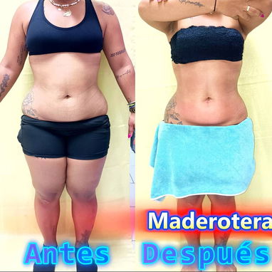 🔥 ¡CAMBIA TU ROSTRO, ELEVA TU BELLEZA HOY! 🔥 ¿Lista para verte más joven, radiante y segura desde la primera sesión? - Img 121663376