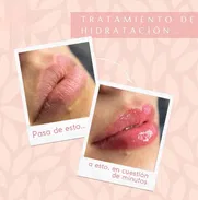 Se realizan tratamientos faciales - Img 50698044