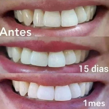 ¿Deseas una sonrisa brillante? - Img 124024251