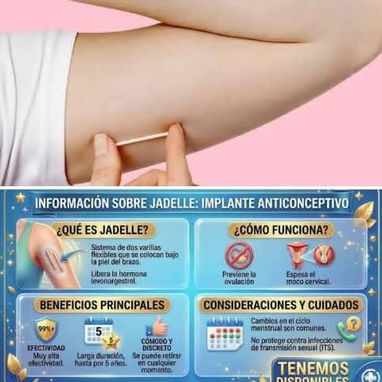 implantes anticonceptivos - Img 123933811
