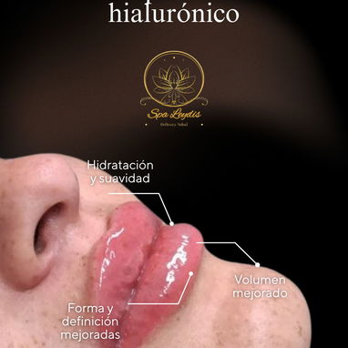 🚨 ¡LLEGÓ TU MOMENTO DE LUCIR LA SONRISA QUE MERECES! ¿Labios más llenos, definidos y súper hidratados? - Img 127434698
