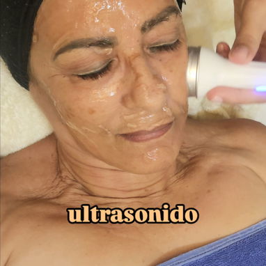 ✨ LIMPIEZA FACIAL PROFUNDA EN LA HABANA ✨ - 6/10
