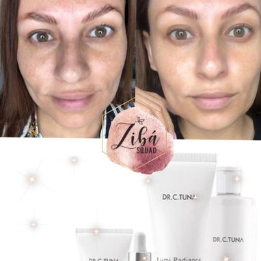 Mascarilla facial Lumi Radiance de la marca Turca FARMASI - Img 118813597