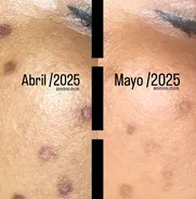 Cursos y talleres de estética facial. - Img 49786479