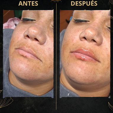 OFERTAS DE VERANO EN SPA_LEYDIS . MARIANAO. CAMBIOS DESDE LA 1RA SESIÓN. - Img 124016089