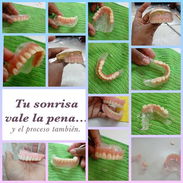 Protesis y ortodoncia. - Img 56757780