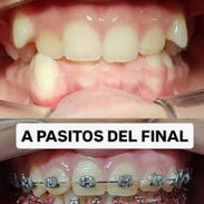 ❣️❣️Ortodoncia a tu alcance💯💯 - Img 56330733