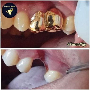 ✨💯Karuko Smiles 🤩✨Sonríe con estilo, Brilla con 🥇✨ Ponte pill@ 😁💪🏻 - 5/10