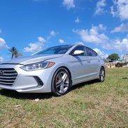 HYUNDAI SONATA 2018 - Img 55463790