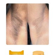 ❌️ ¿Manchas, estrías o acne en tu piel? - Img 55347648