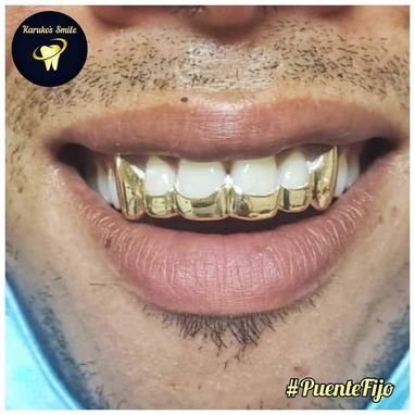 ✨💯Karuko Smiles 🤩✨Sonríe con estilo, Brilla con 🥇✨ Ponte pill@ 😁💪🏻 - 10/10