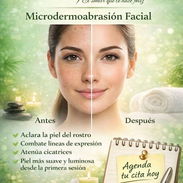Microabrasion facial - Img 56277957