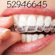 Retenedores de ortodoncia Ferula de Ortodoncia - Img 45227670