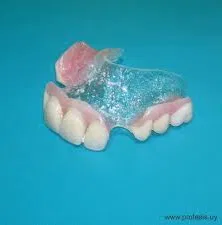 Servicios de prótesis dental - Img 94700826