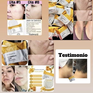 Ofertaaaa Set de crema facial y jabón de caléndula(jabón de regalo) - Img 119545904