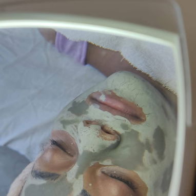 Limpieza facial profunda con Aparatologia - Img 122928355