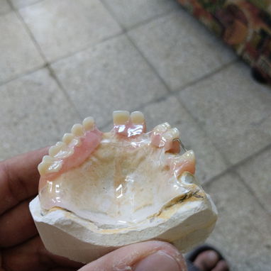 Se reparan y se hacen protesis - Img 127979225