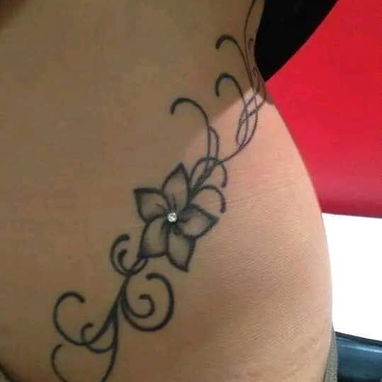 Colocación de microdermal - 5/7