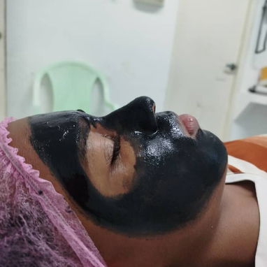 Tratamientos anti acné manchas y arrugas y limpieza facial profunda - Img 119003779