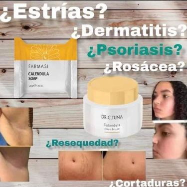 Bálsamo de Caléndula Original 🌿 | Irritaciones, piel seca, acné, bebés | Entrega en La Habana - Img 116760195