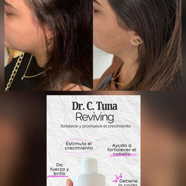 ✨🌿 Shampoo, Mascarilla y Aceite ¡Recupera la fuerza y belleza de tu cabello! 🌿✨ - Img 123534543
