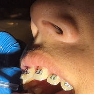 Servicios Dentales / Ortodoncia /Carillas/Prótesis - Img 56058184