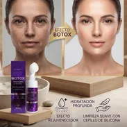 Botox facial - Img 57720184