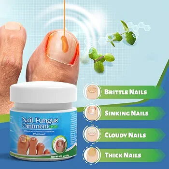 Ungüento para hongos en las uñas, 20 g - Tratamiento eficaz para hongos en las uñas y pie de atleta - Ungüento antimicót - 2/3